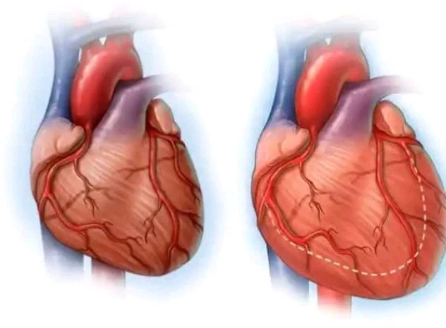 heart